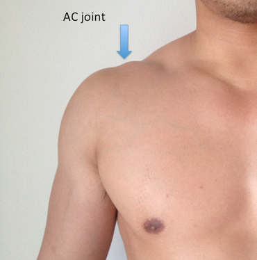 AC Joint - FIT AS A PHYSIO